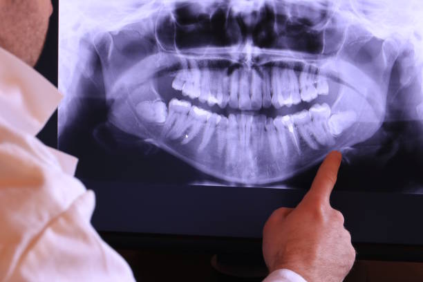 Best Weekend Emergency Dentist in Chickamau, GA