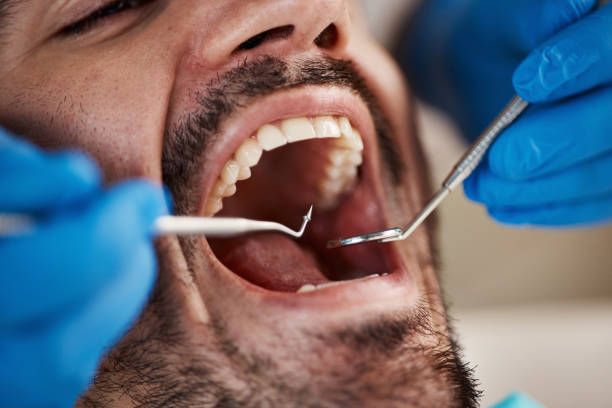 Best Pediatric Emergency Dentist in Chickamau, GA