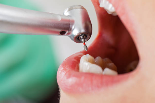 Best Orthodontic Emergency Dentist in Chickamau, GA